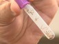 Encontrados mais sete focos do mosquito da Dengue esta semana, em So Jos do Cedro apesar do intenso trabalho preventivo