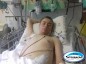 Jovem cedrense, que recebeu transplante de rim, tem alta hospitalar no Rio Grande do Sul